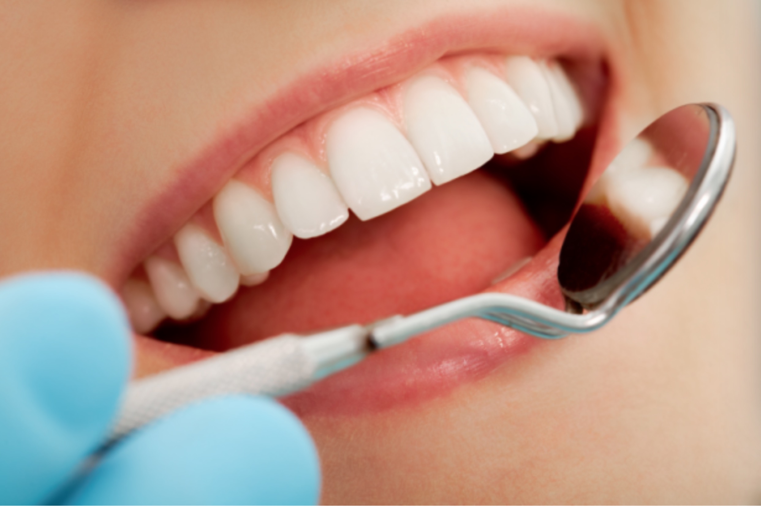 乳牙常见疾病牙髓病的原因和预防